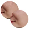 Exfoliante Profesional Desmanchador