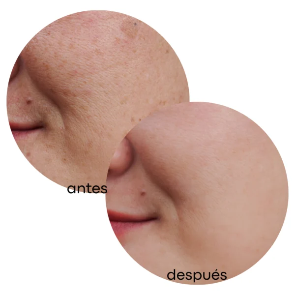 Exfoliante Profesional Desmanchador