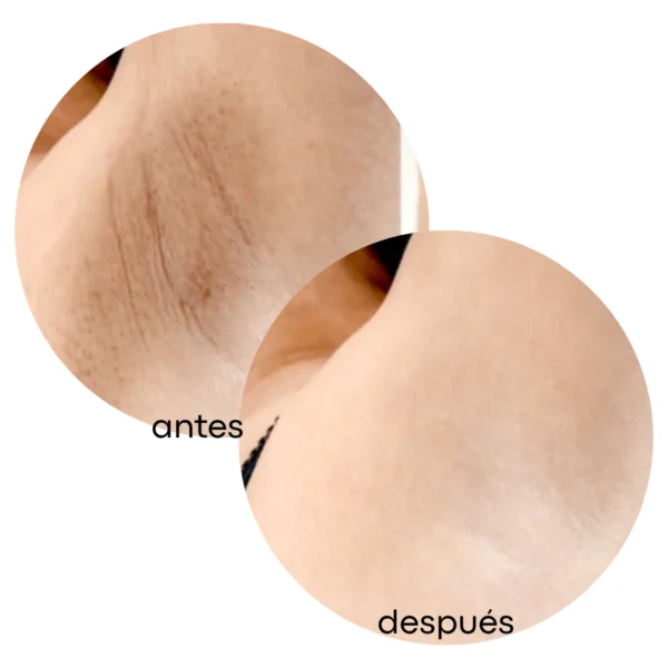 Exfoliante Profesional Desmanchador