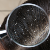 Shampoo Solido |  Anticaspa